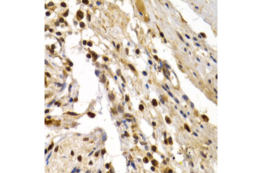Immunohistochemistry - TFDP1 Antibody from Signalway Antibody (32846) - Antibodies.com