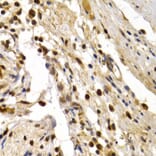 Immunohistochemistry - TFDP1 Antibody from Signalway Antibody (32846) - Antibodies.com