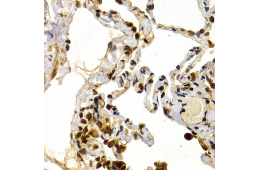 Immunohistochemistry - TFDP1 Antibody from Signalway Antibody (32846) - Antibodies.com