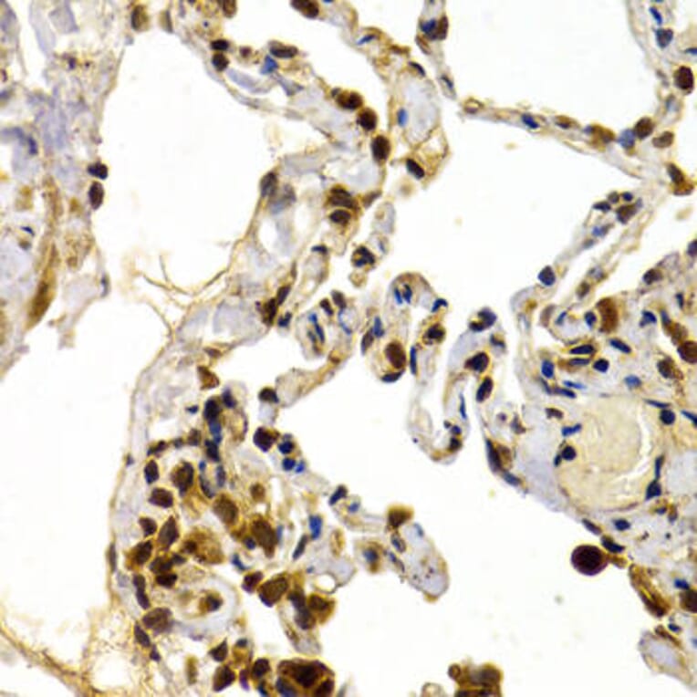 Immunohistochemistry - TFDP1 Antibody from Signalway Antibody (32846) - Antibodies.com