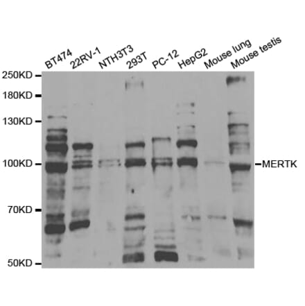 Western blot - MERTK Antibody from Signalway Antibody (32851) - Antibodies.com