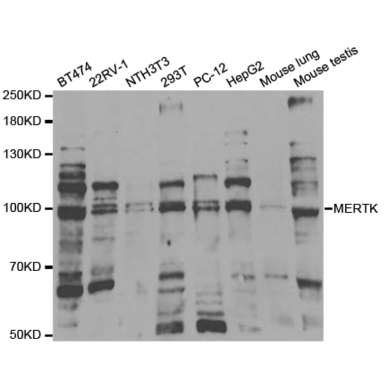 Western blot - MERTK Antibody from Signalway Antibody (32851) - Antibodies.com