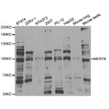 Western blot - MERTK Antibody from Signalway Antibody (32851) - Antibodies.com