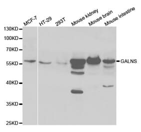 Western blot - GALNS Antibody from Signalway Antibody (32862) - Antibodies.com