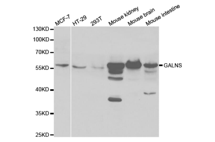 Western blot - GALNS Antibody from Signalway Antibody (32862) - Antibodies.com