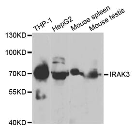 Western blot - IRAK3 Antibody from Signalway Antibody (32867) - Antibodies.com