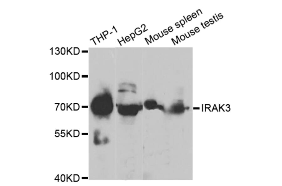 Western blot - IRAK3 Antibody from Signalway Antibody (32867) - Antibodies.com