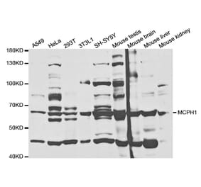 Western blot - MCPH1 Antibody from Signalway Antibody (32871) - Antibodies.com