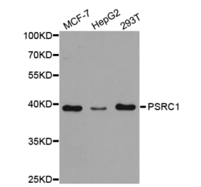 Western blot - PSRC1 Antibody from Signalway Antibody (32879) - Antibodies.com