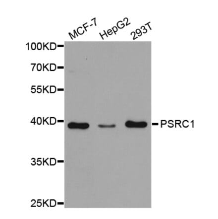 Western blot - PSRC1 Antibody from Signalway Antibody (32879) - Antibodies.com