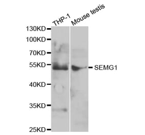 Western blot - SEMG1 Antibody from Signalway Antibody (32882) - Antibodies.com