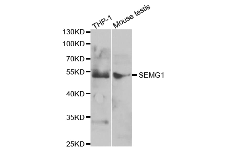 Western blot - SEMG1 Antibody from Signalway Antibody (32882) - Antibodies.com