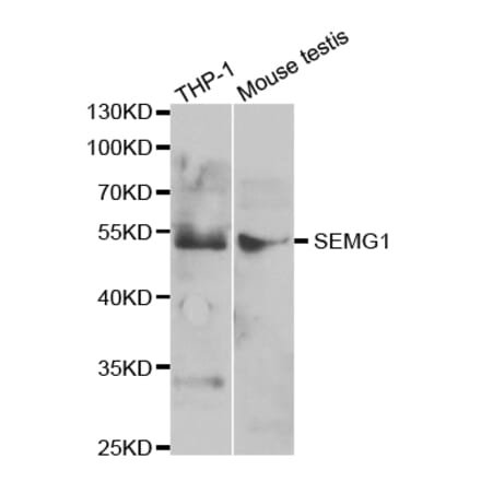 Western blot - SEMG1 Antibody from Signalway Antibody (32882) - Antibodies.com