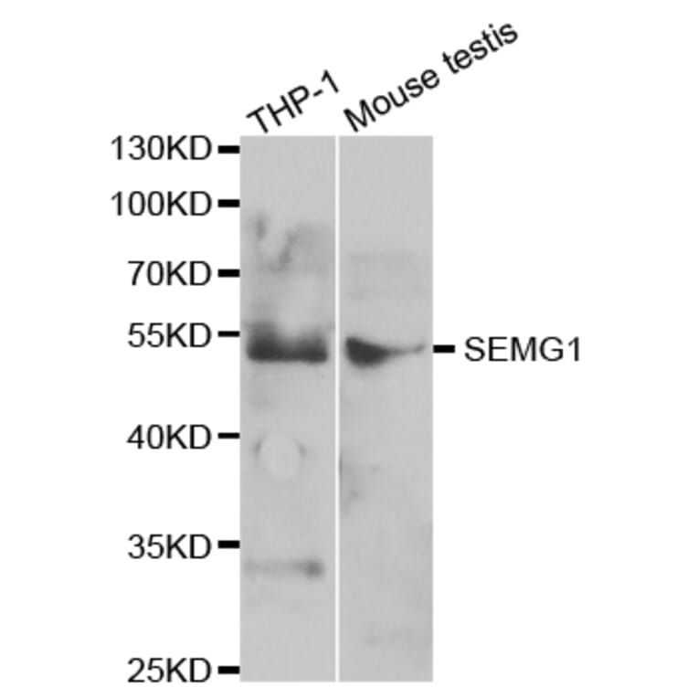 Western blot - SEMG1 Antibody from Signalway Antibody (32882) - Antibodies.com