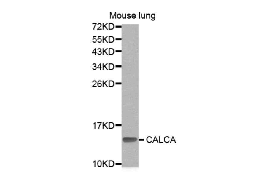 Western blot - CALCA Antibody from Signalway Antibody (32898) - Antibodies.com