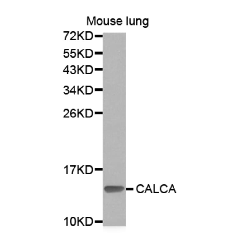 Western blot - CALCA Antibody from Signalway Antibody (32898) - Antibodies.com
