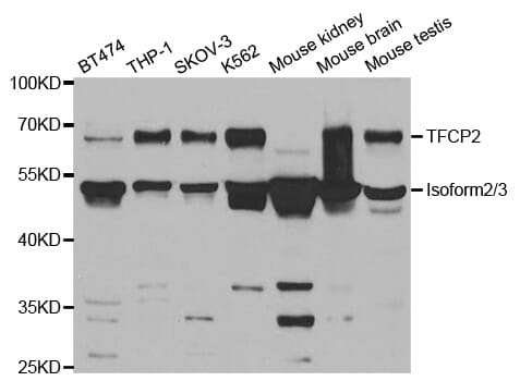 Western blot analysis of extracts of various cell lines, using TFCP2 antibody.