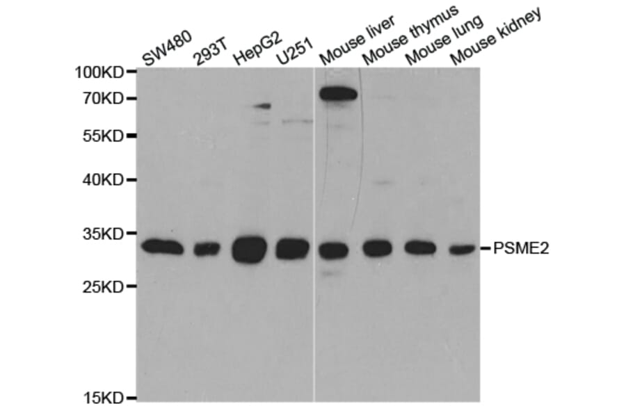 Western blot - PSME2 Antibody from Signalway Antibody (32913) - Antibodies.com
