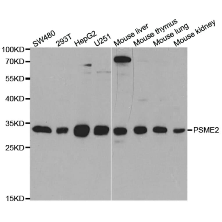 Western blot - PSME2 Antibody from Signalway Antibody (32913) - Antibodies.com