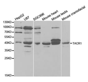 Western blot - TACR1 Antibody from Signalway Antibody (32916) - Antibodies.com