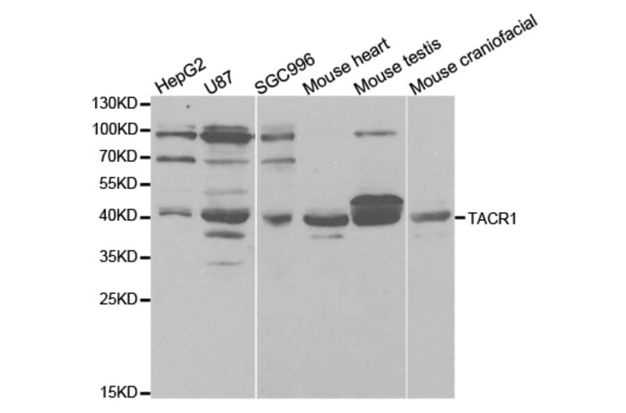 Western blot - TACR1 Antibody from Signalway Antibody (32916) - Antibodies.com