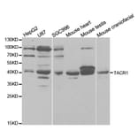 Western blot - TACR1 Antibody from Signalway Antibody (32916) - Antibodies.com