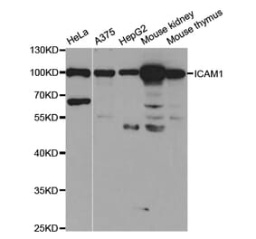 Western blot - ICAM1 Antibody from Signalway Antibody (32918) - Antibodies.com