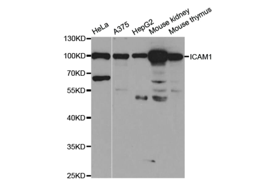 Western blot - ICAM1 Antibody from Signalway Antibody (32918) - Antibodies.com