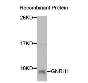 Western blot - GNRH1 Antibody from Signalway Antibody (32930) - Antibodies.com