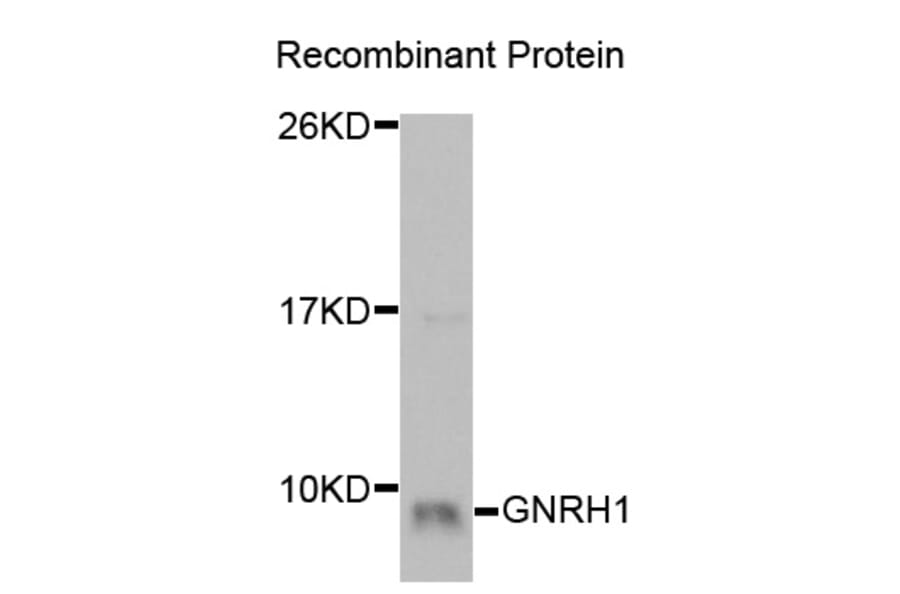 Western blot - GNRH1 Antibody from Signalway Antibody (32930) - Antibodies.com