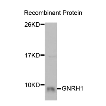 Western blot - GNRH1 Antibody from Signalway Antibody (32930) - Antibodies.com