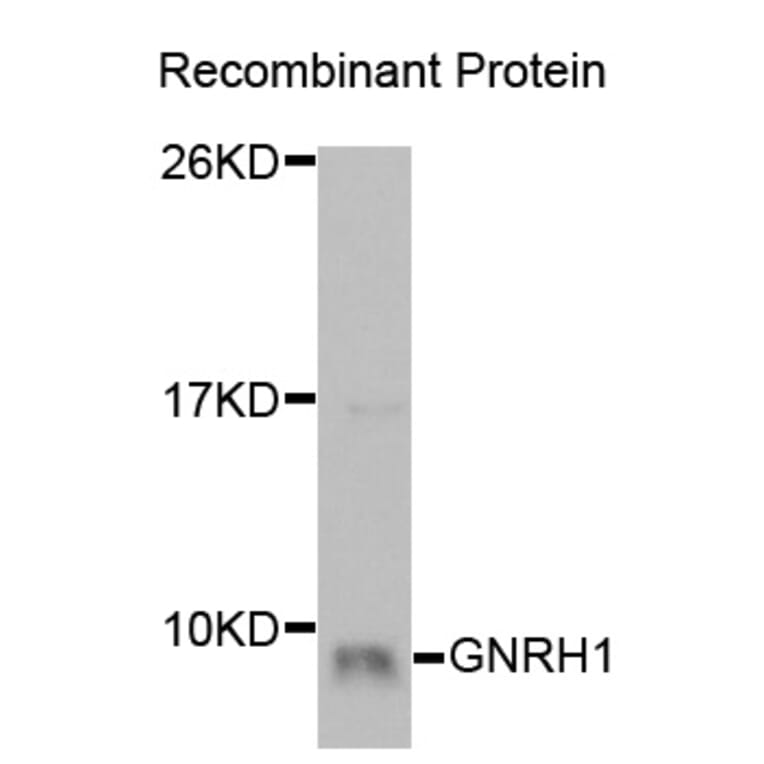 Western blot - GNRH1 Antibody from Signalway Antibody (32930) - Antibodies.com
