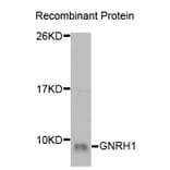 Western blot - GNRH1 Antibody from Signalway Antibody (32930) - Antibodies.com