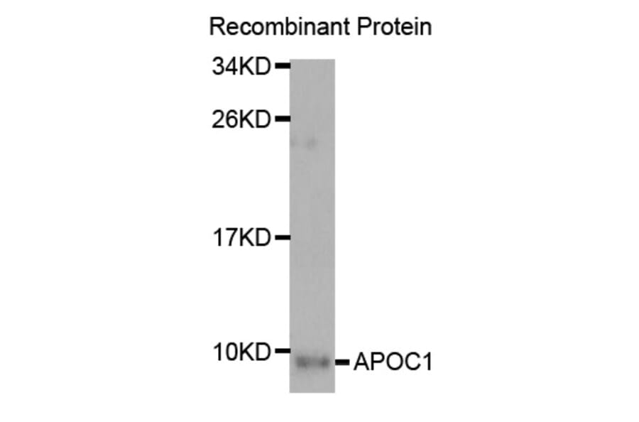 Western blot - APOC1 Antibody from Signalway Antibody (32934) - Antibodies.com