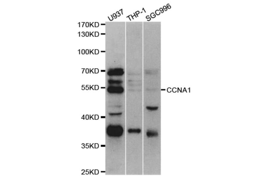 Western blot - CCNA1 Antibody from Signalway Antibody (32936) - Antibodies.com