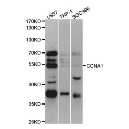 Western blot - CCNA1 Antibody from Signalway Antibody (32936) - Antibodies.com