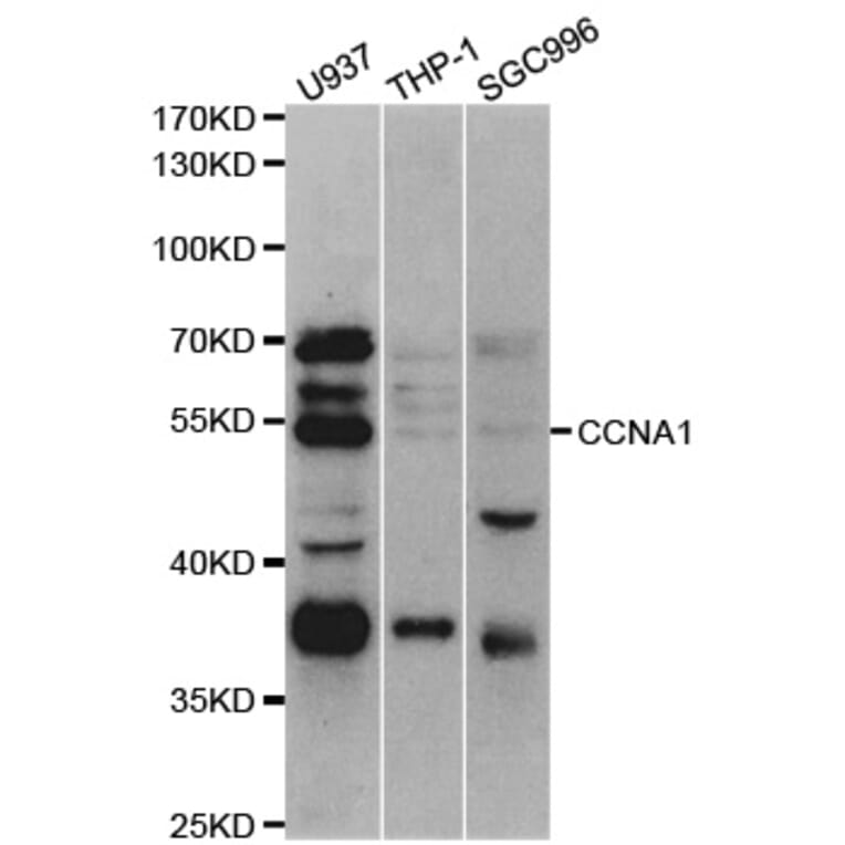 Western blot - CCNA1 Antibody from Signalway Antibody (32936) - Antibodies.com