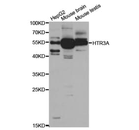Western blot - HTR3A Antibody from Signalway Antibody (32946) - Antibodies.com