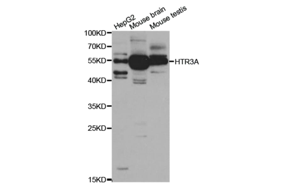 Western blot - HTR3A Antibody from Signalway Antibody (32946) - Antibodies.com