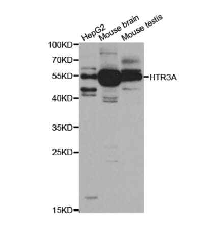 Western blot - HTR3A Antibody from Signalway Antibody (32946) - Antibodies.com