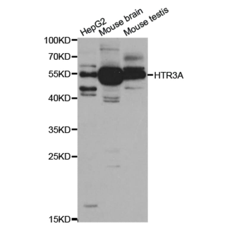 Western blot - HTR3A Antibody from Signalway Antibody (32946) - Antibodies.com