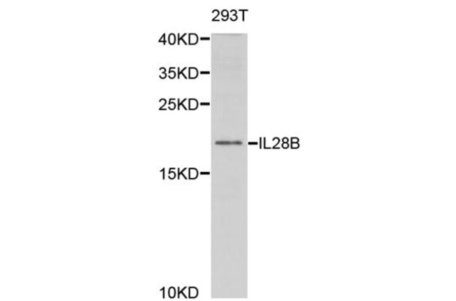 Western blot - IL28B Antibody from Signalway Antibody (32947) - Antibodies.com
