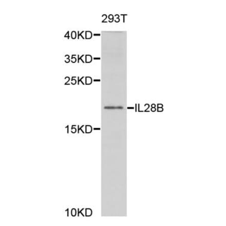 Western blot - IL28B Antibody from Signalway Antibody (32947) - Antibodies.com