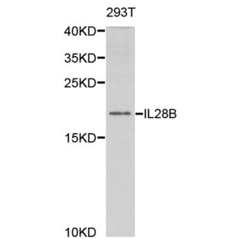 Western blot - IL28B Antibody from Signalway Antibody (32947) - Antibodies.com
