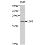 Western blot - IL28B Antibody from Signalway Antibody (32947) - Antibodies.com