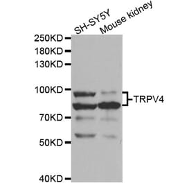 Western blot - TRPV4 Antibody from Signalway Antibody (32956) - Antibodies.com