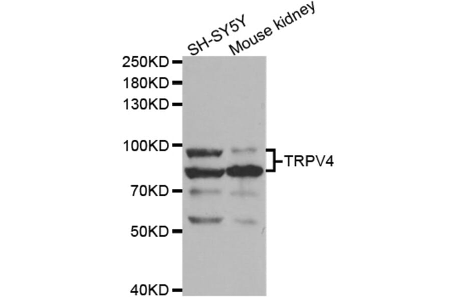 Western blot - TRPV4 Antibody from Signalway Antibody (32956) - Antibodies.com