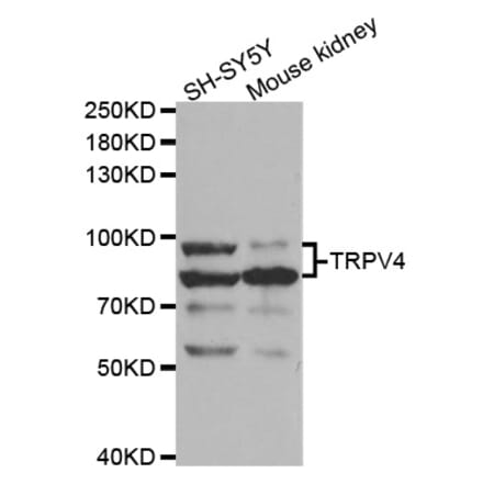 Western blot - TRPV4 Antibody from Signalway Antibody (32956) - Antibodies.com