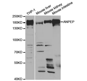 Western blot - ANPEP Antibody from Signalway Antibody (32957) - Antibodies.com