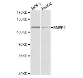 Western blot - BMPR2 Antibody from Signalway Antibody (32961) - Antibodies.com